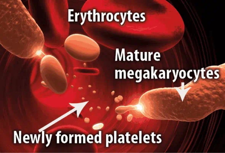 Adult ITP treated with Nplate®, a TPO mimetic